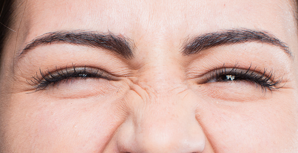 Causes of Bunny Lines